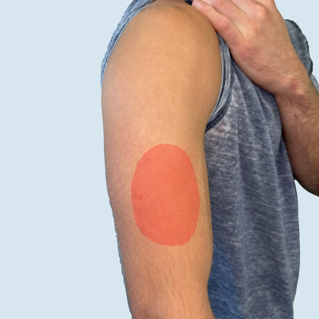 Placement on arm